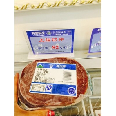 上脑切片